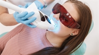 proven mobile teeth whitening - 1