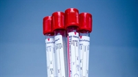 laboratory with medicare medi-cal - 1
