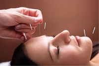 successful acupuncture clinic 37 - 1