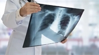 invest a chiropractic center - 1