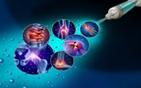 non-surgical joint pain injury - 1