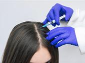 high-margin hair restoration business
